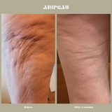 ADIPEAU Strong Body Gel
