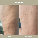 ADIPEAU Strong Body Gel