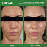 ADIPEAU Active Face Cream